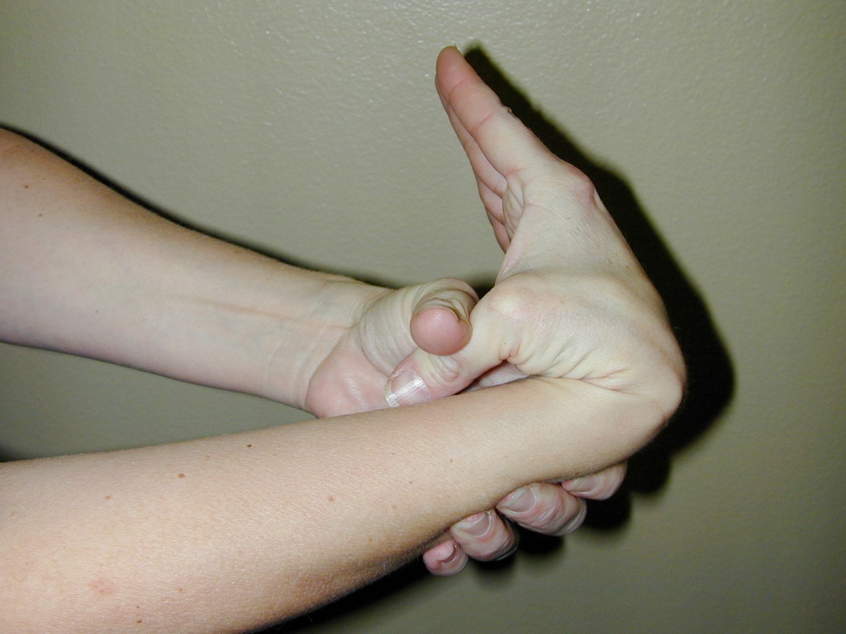 Joint Hypermobility